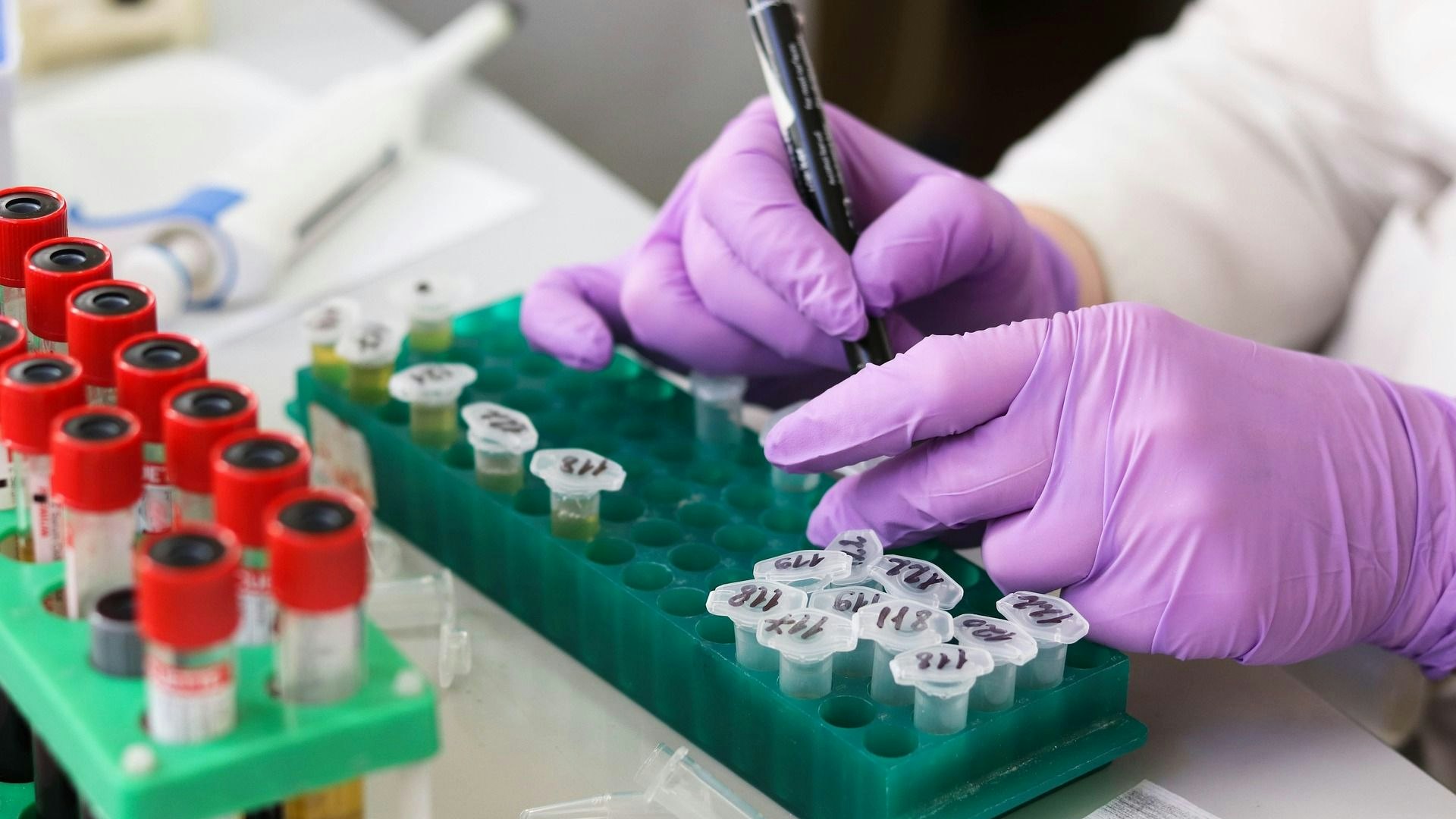 A laboratory technician labels samples.